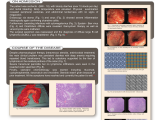 poster-rapid-lymphoma-development
